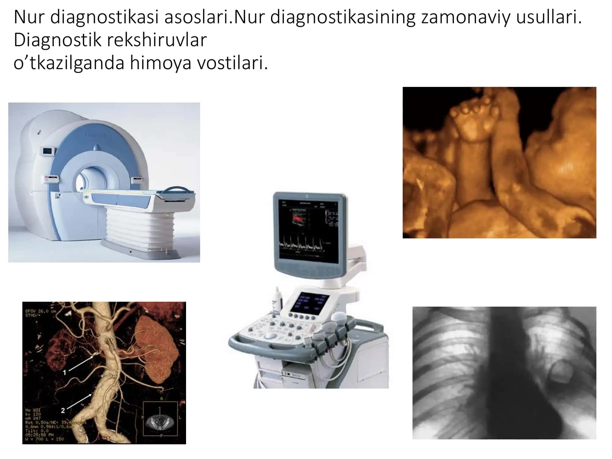 Nur tashxisi 1
