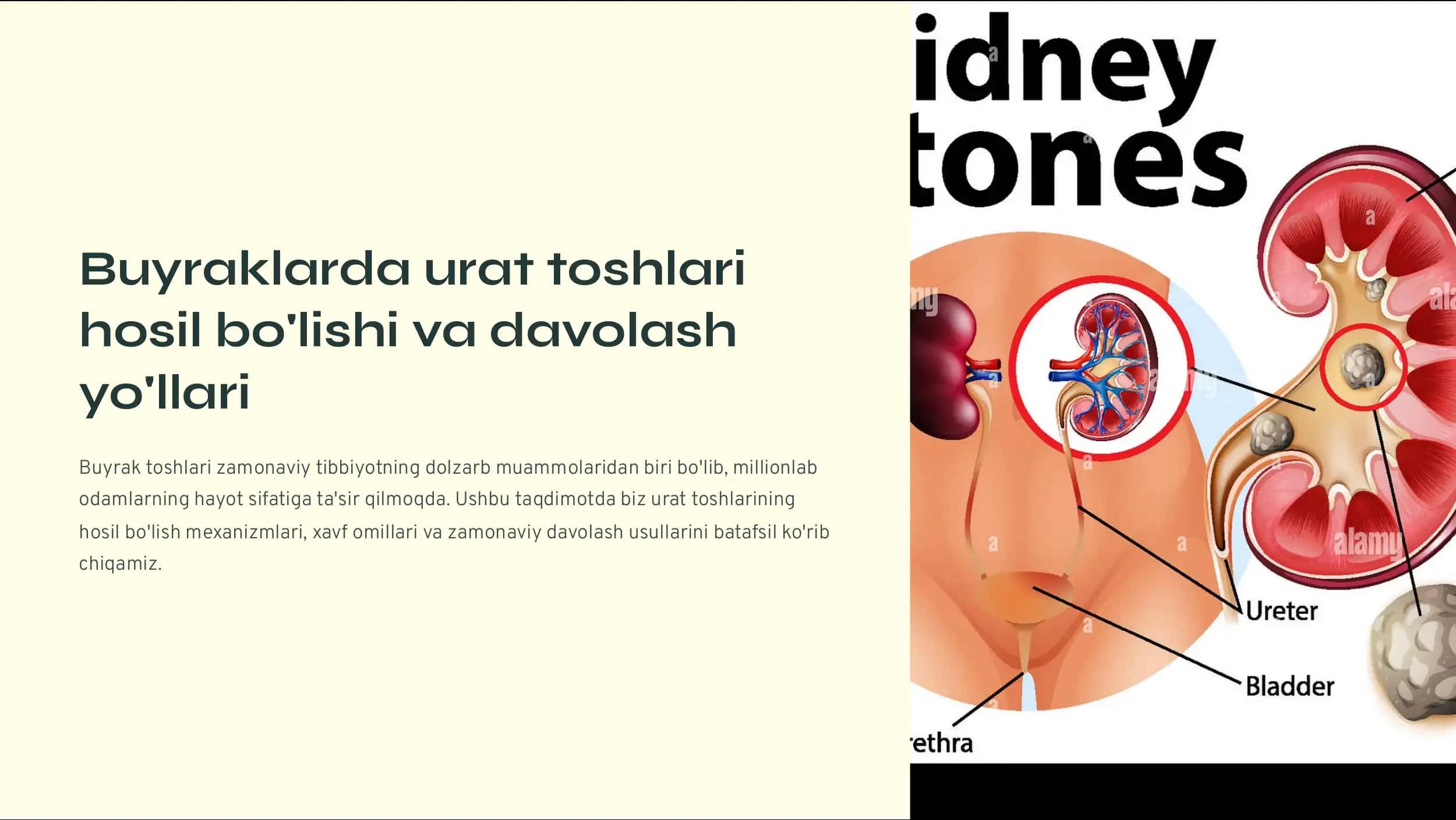 Urat toshlari 1