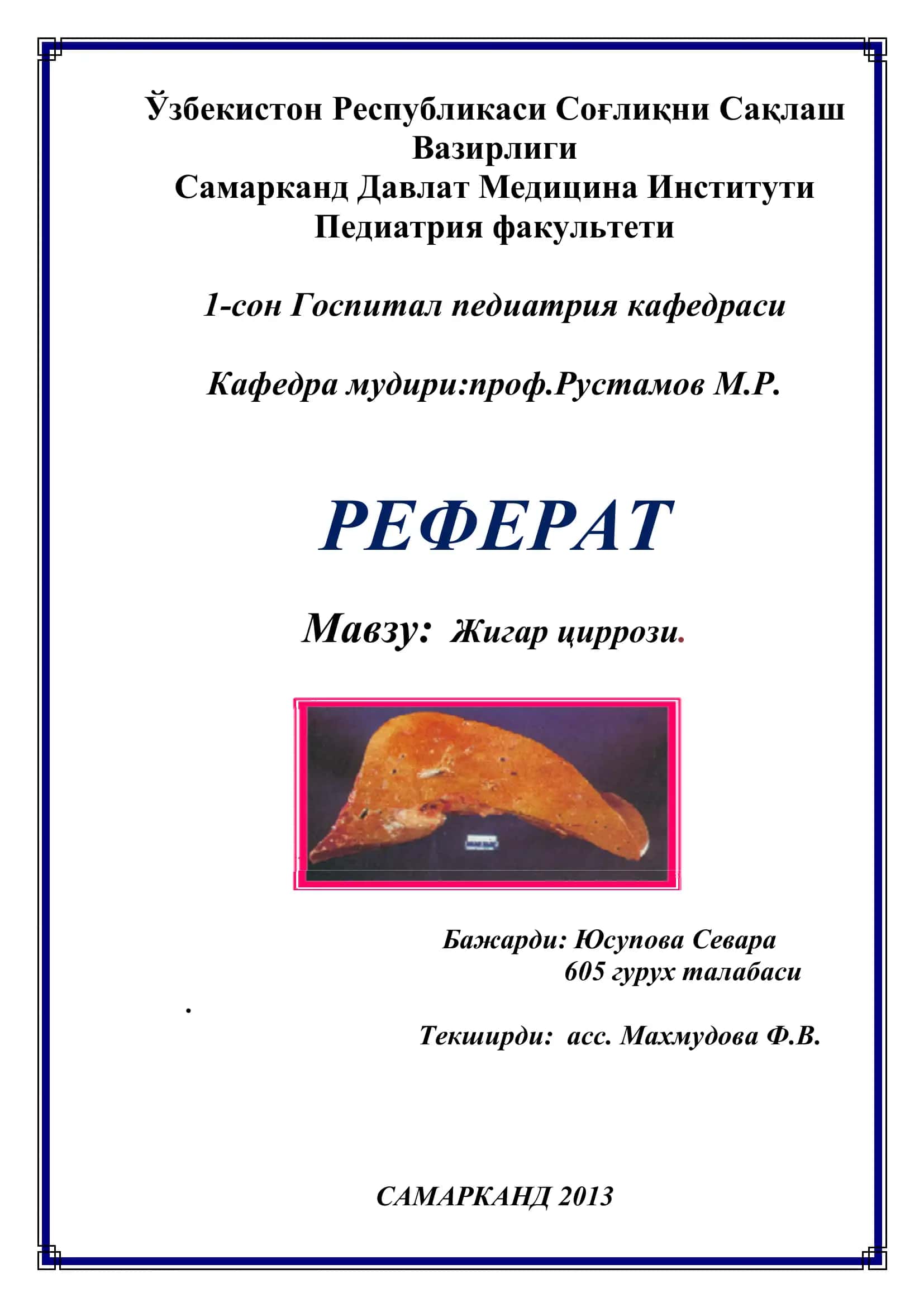 Жигар циррози 1