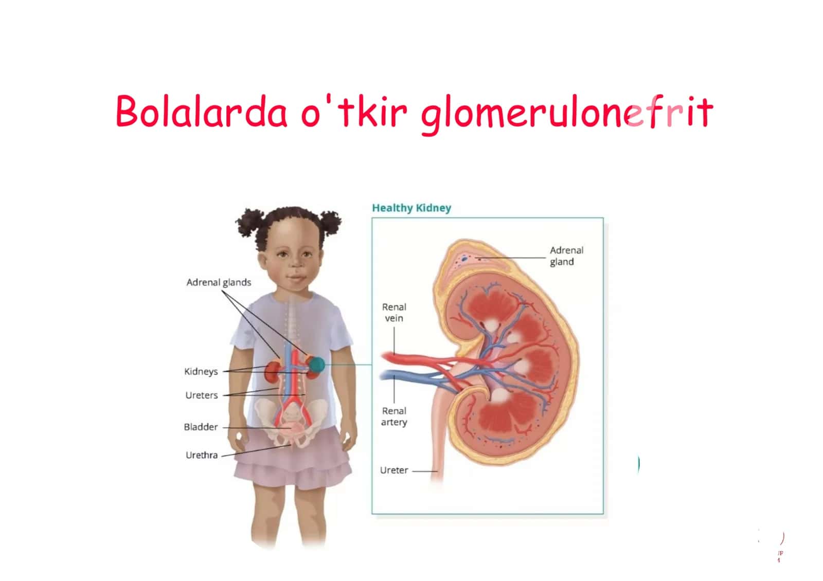 Glomerulonefrit toliq 25 list ppt 1