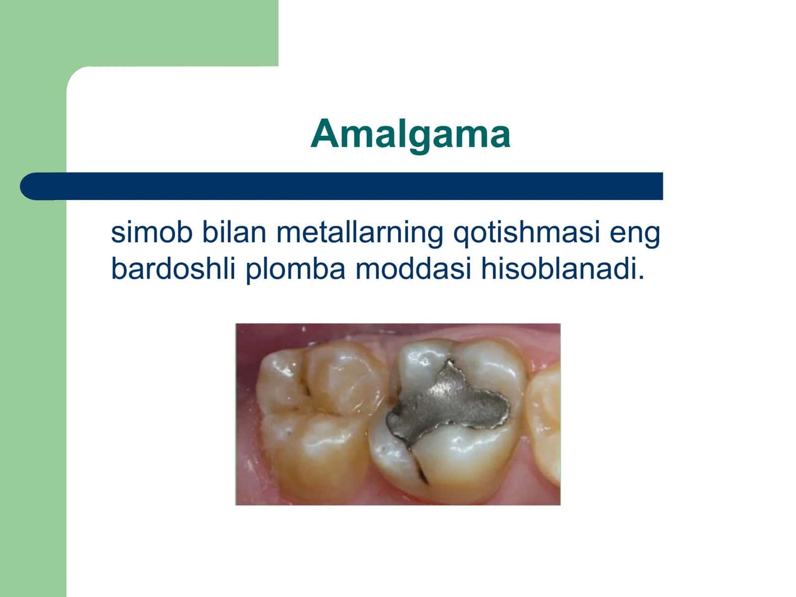 Amalgamalar 2