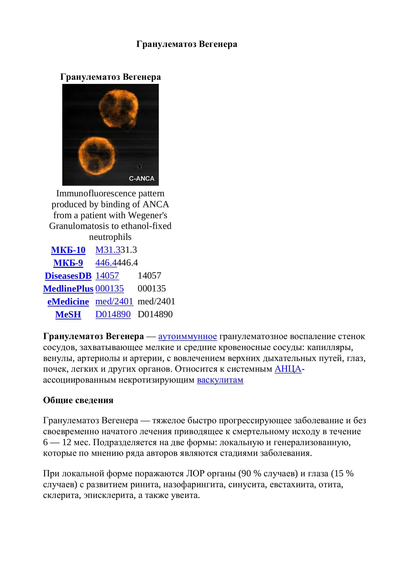 Гранулематоз Вегенера 2