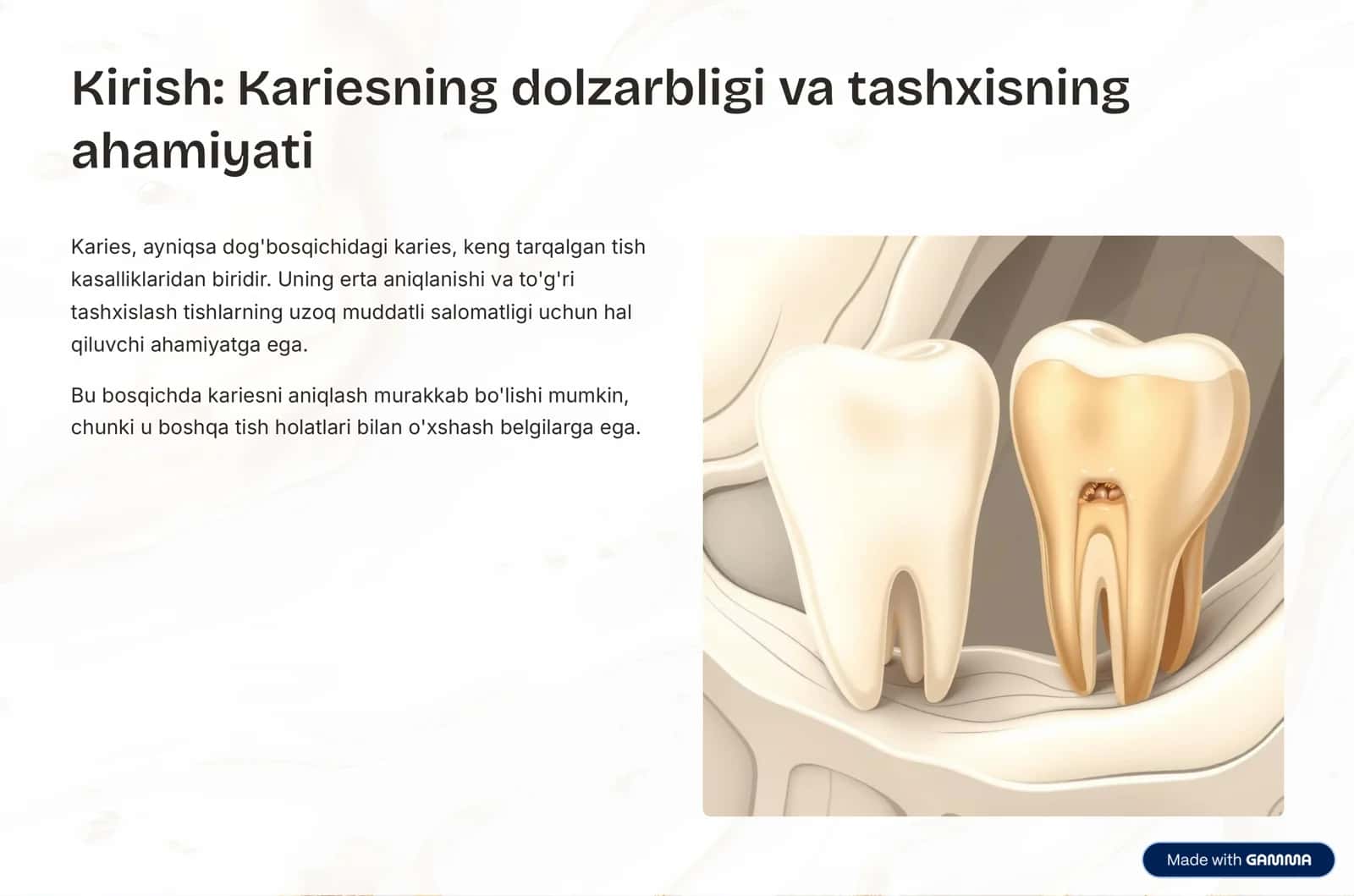 Kariesni qiyosiy tashxislash 2
