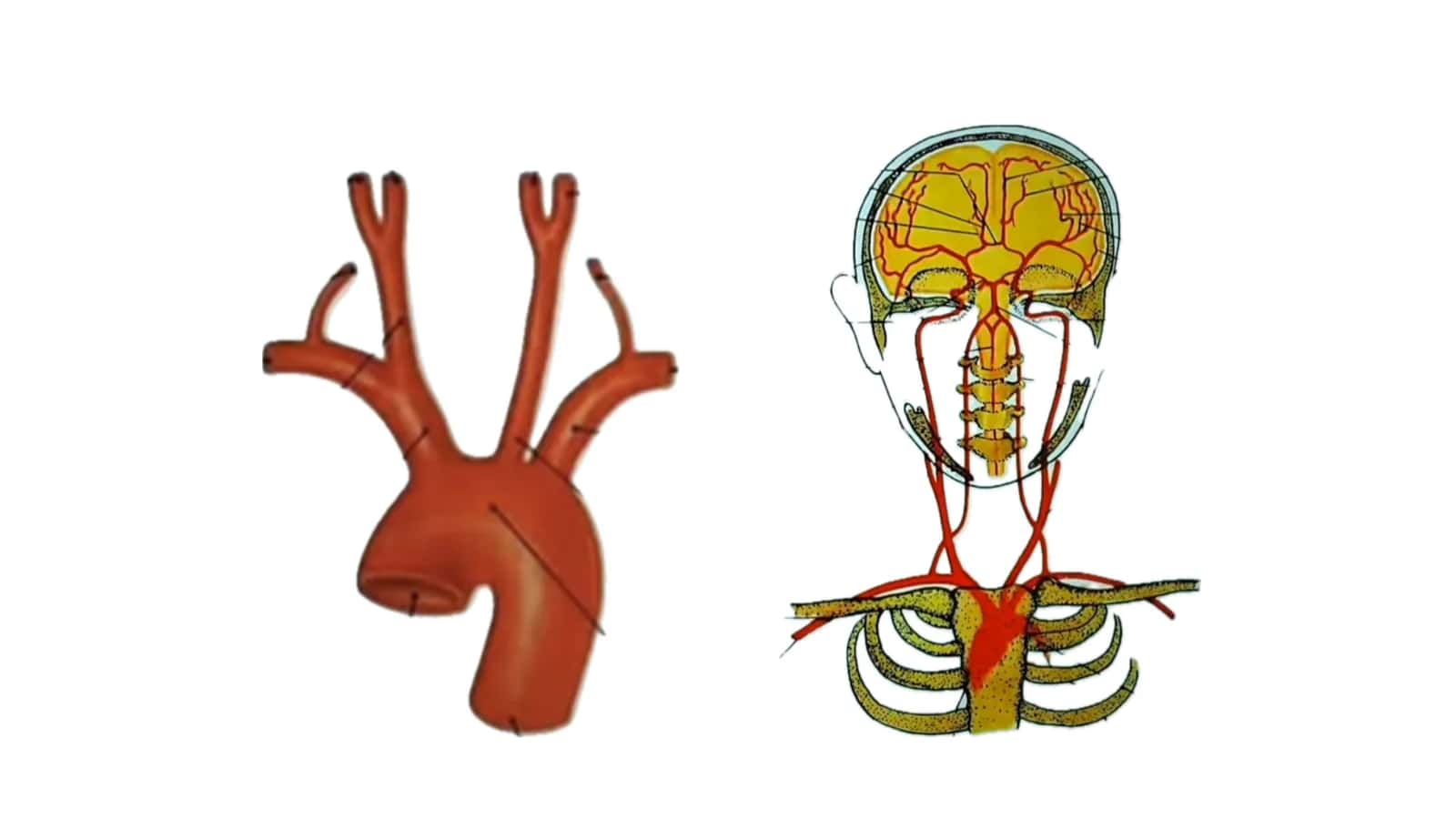ICHKI UYQU ARTERIYASI 2