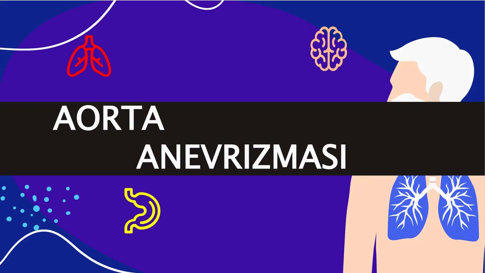 Aorta anevrizmasi 2