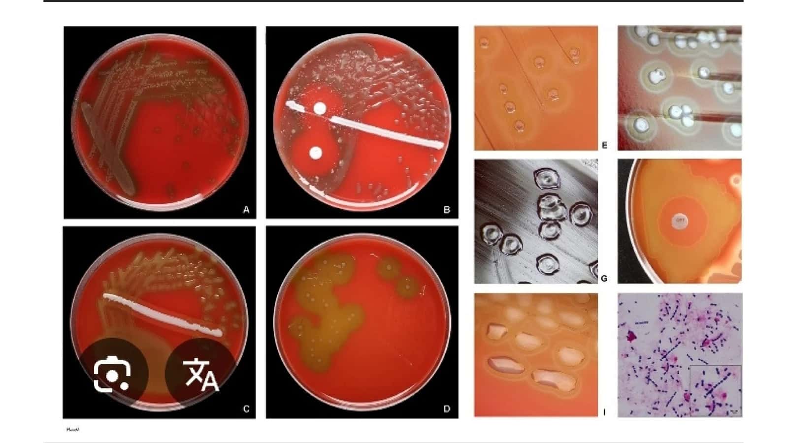 MIKROBIOLOGIYA 3
