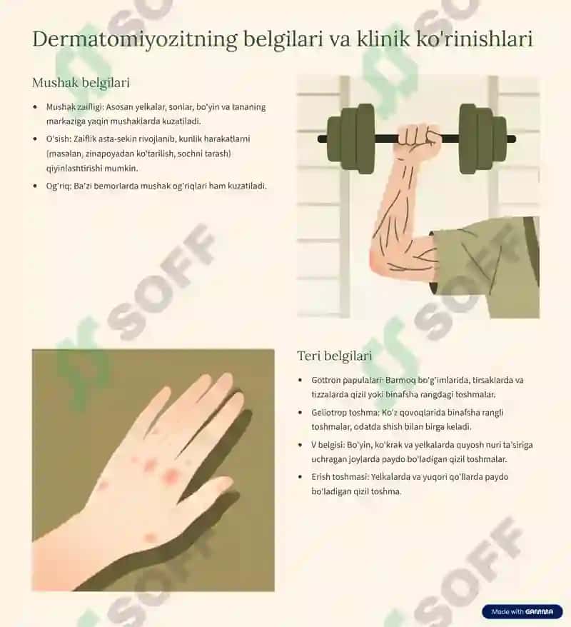 Dermatomiyozitlar-Taniqlash-va-Boshqarish 4