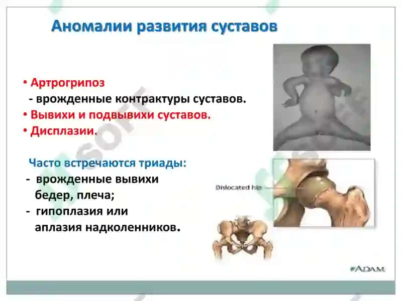 Артрология 8