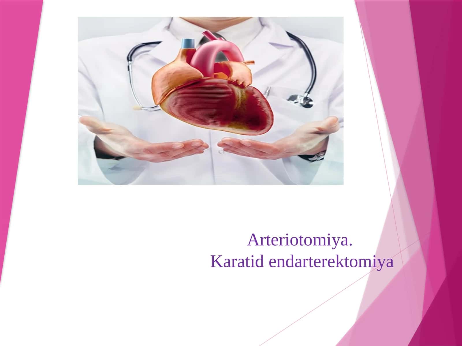 Arteriotomiya.Karatidendarterektomiya 1