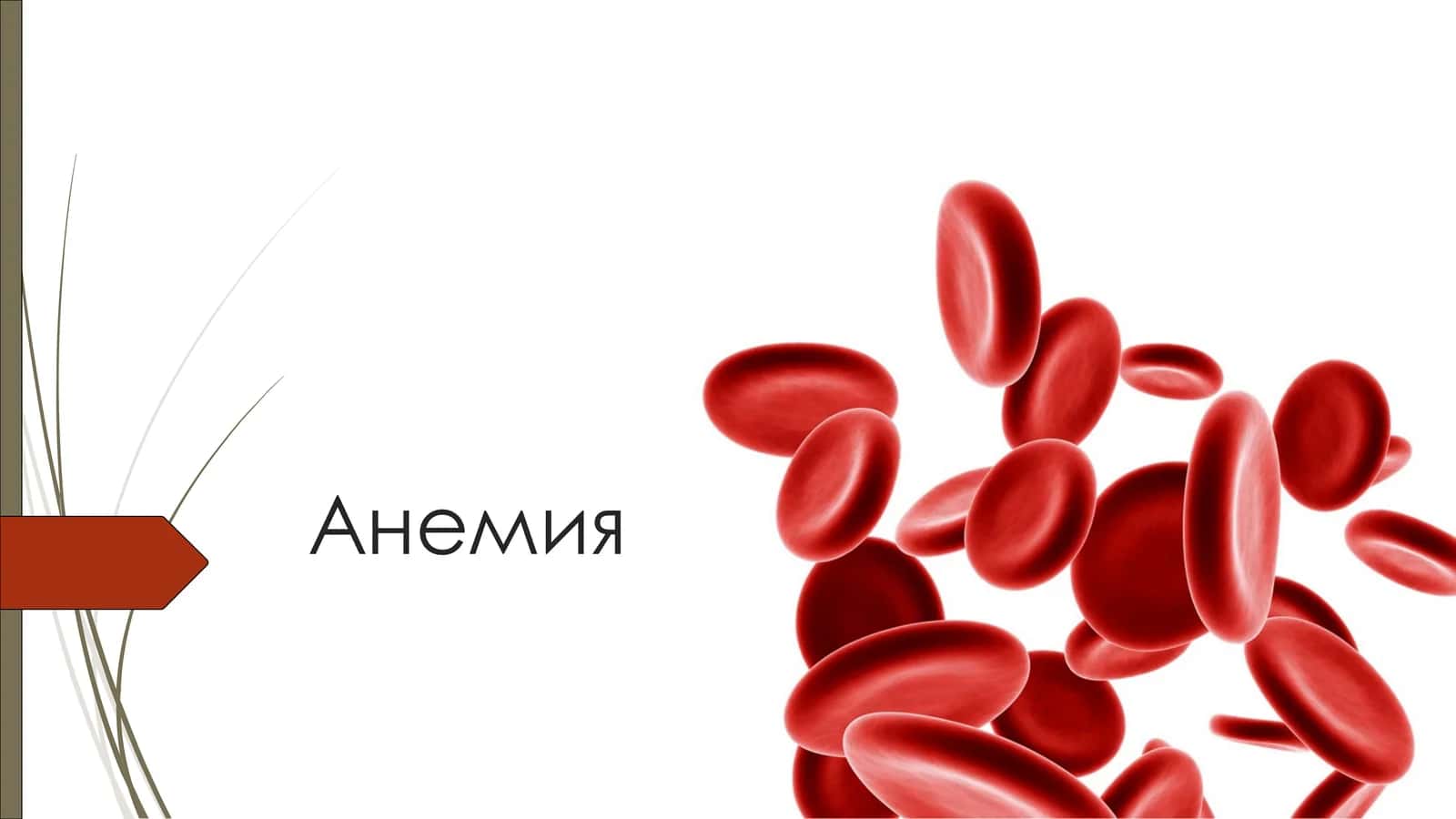 Анемия 1