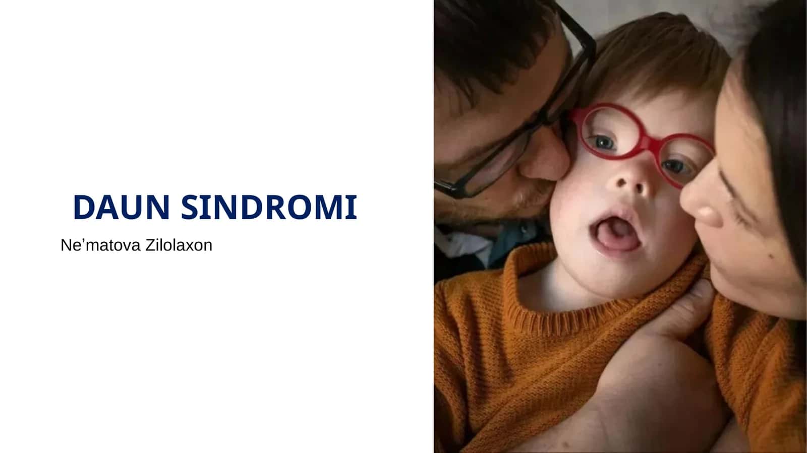 DAUN SINDROMI 1