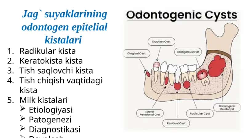 Jag` suyaklarining odontogen epitelial kistalari 1