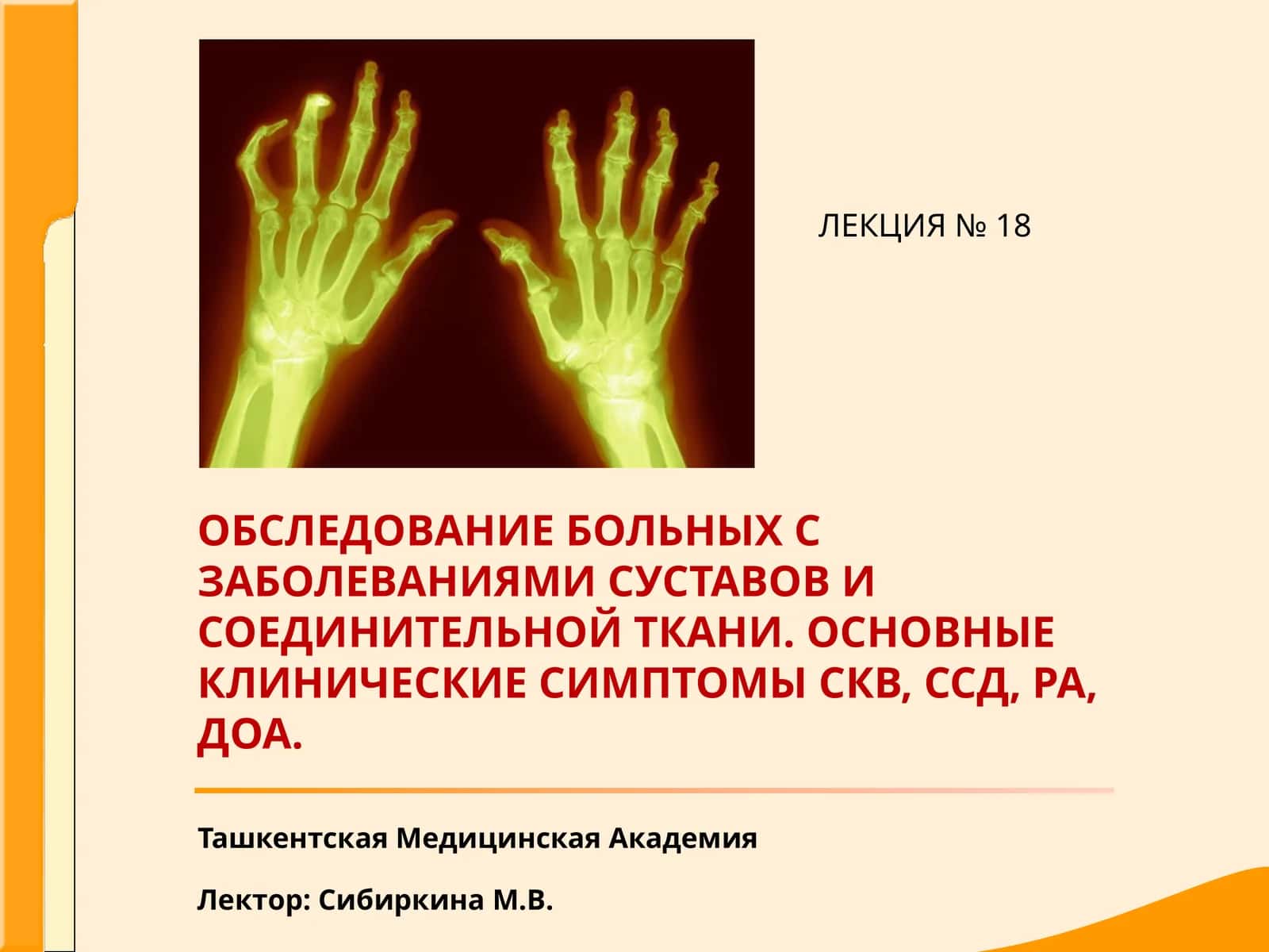 Диффузные заболевания соединительной ткани 1