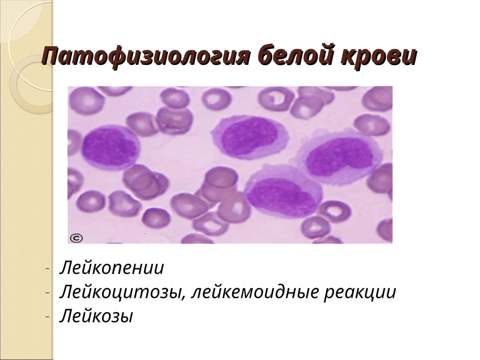 Патологическая лейкопения 1