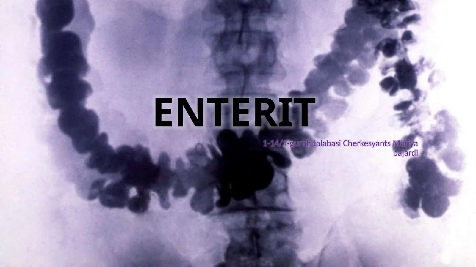 Enterit ingichka ichak yallig'lanishi (2-variant) 1