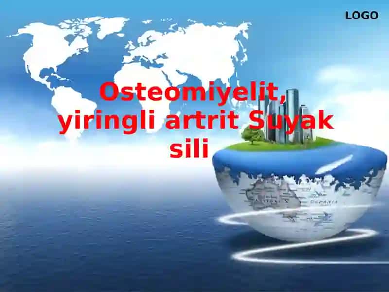 Osteomiyelit