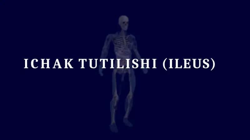 Ichak tutilishi taqdimot 1