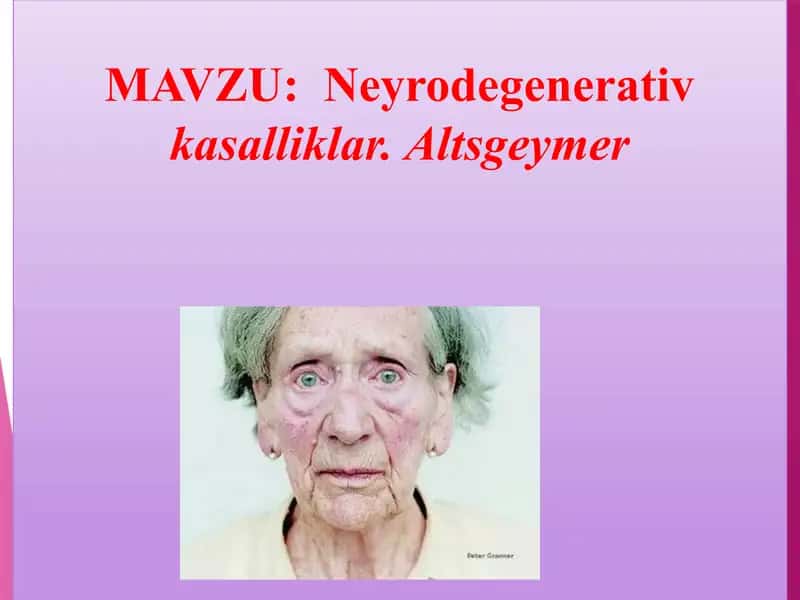 Altsgeymer 1