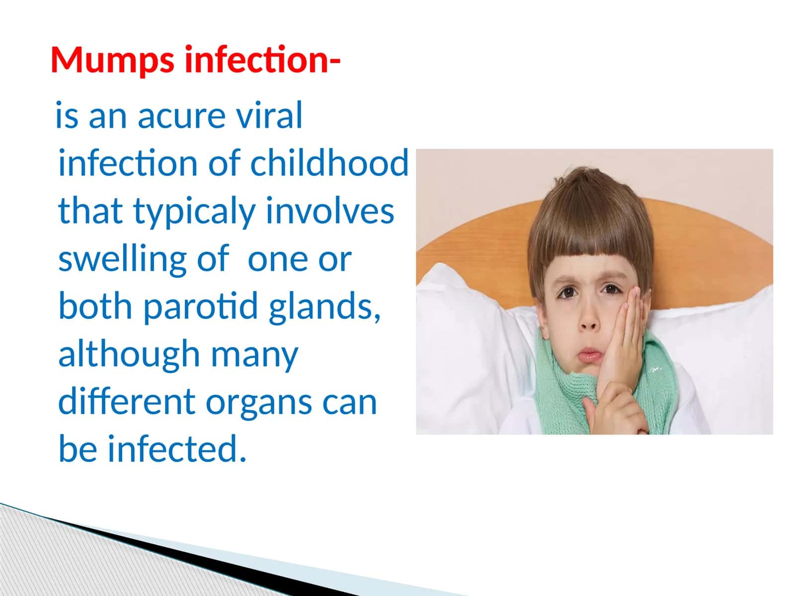 Mumps infection 1
