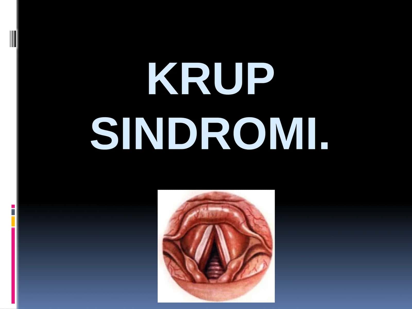 Krup sindromi 1