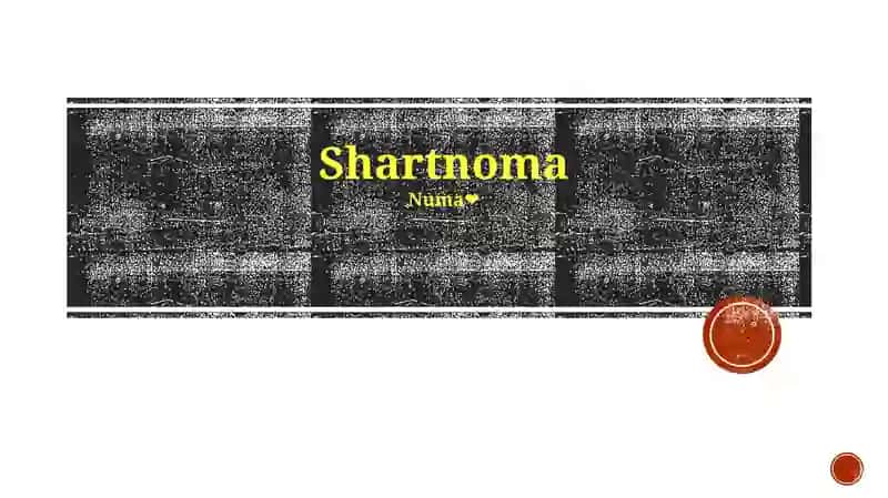 Shartnoma