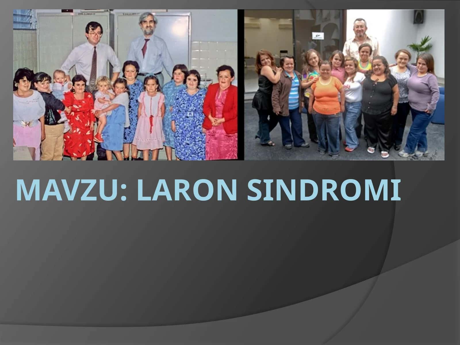 Laron Sindromi 1