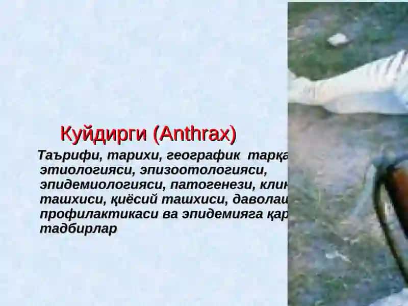 Kuydirgi (Anthrax)