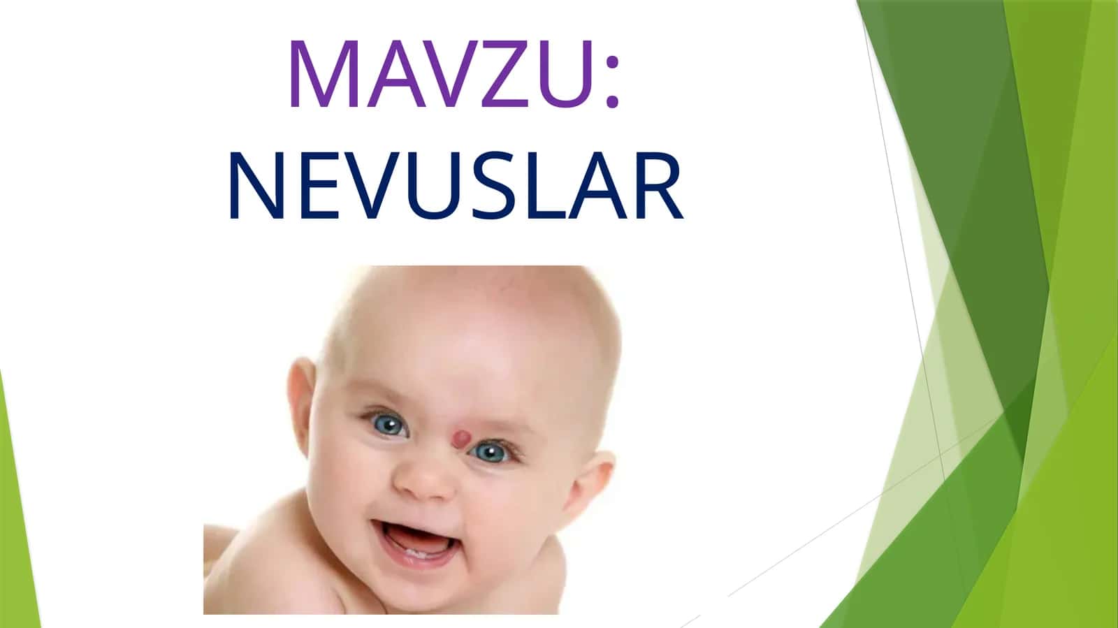 NEVUSLAR 1