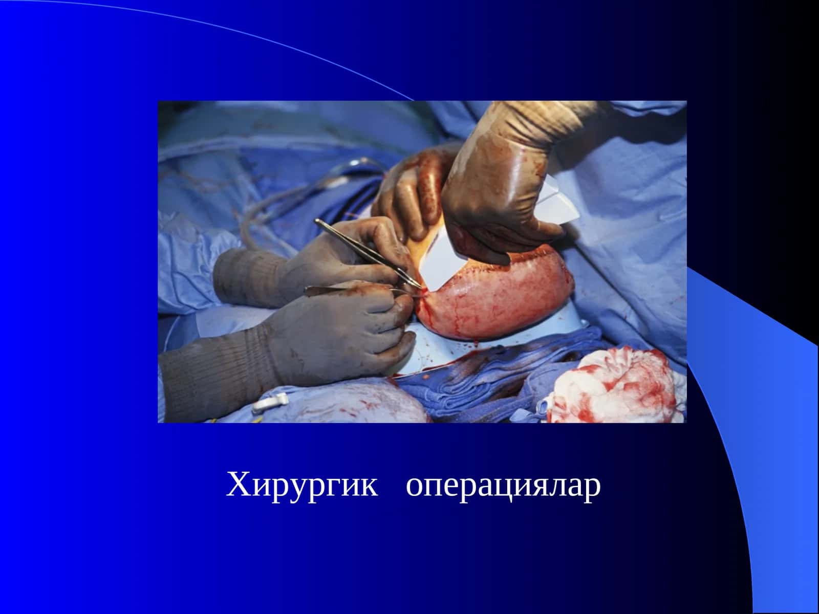 Хирургик операциялар 1