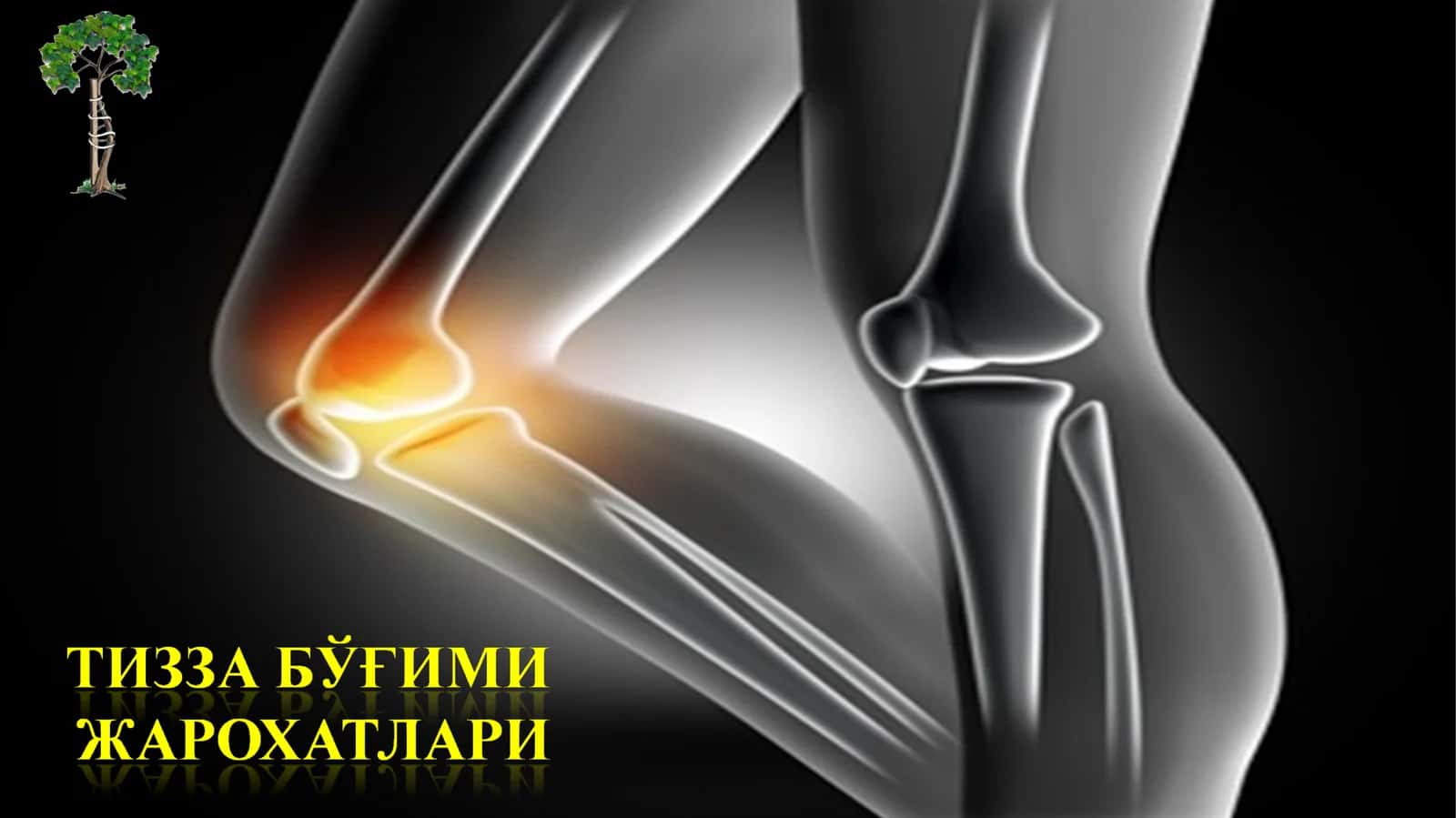 Таснифи 1