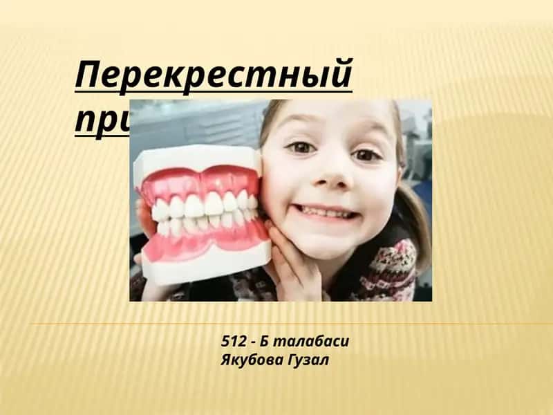 Перекрестный прикус 1