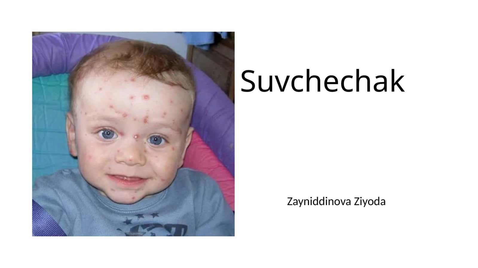 Сувчечак 1