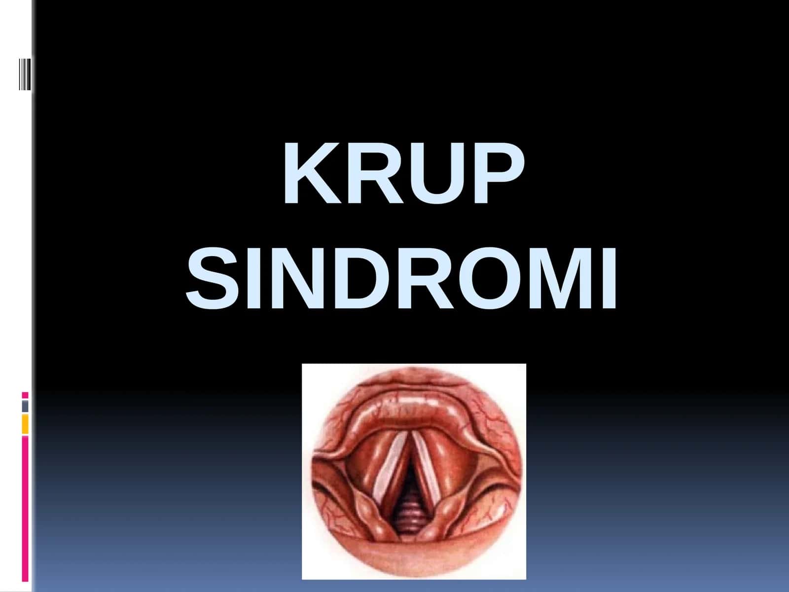 Krupsindromi 1