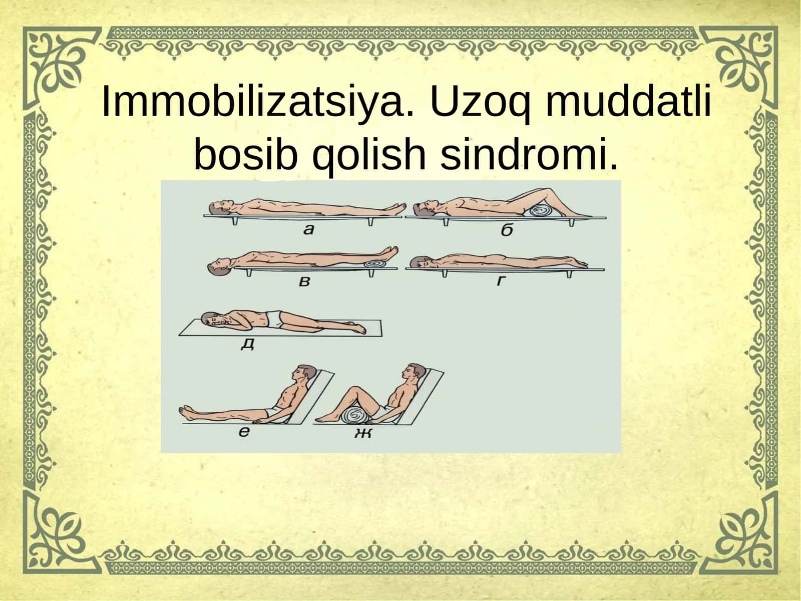 Immobilizatsiya.Uzoq muddatli bosib qolish sindromi 1