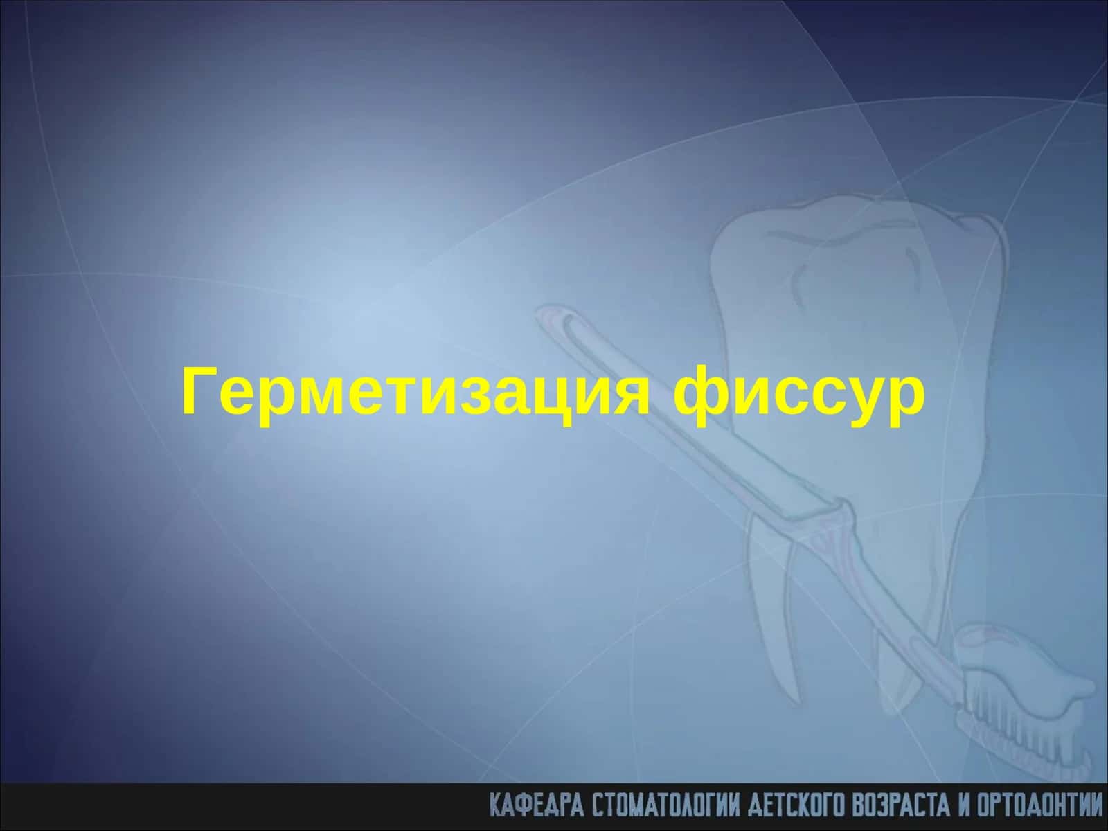 Герметизация фиссур 1