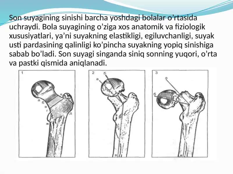Sonsuyagining sinishlari 1