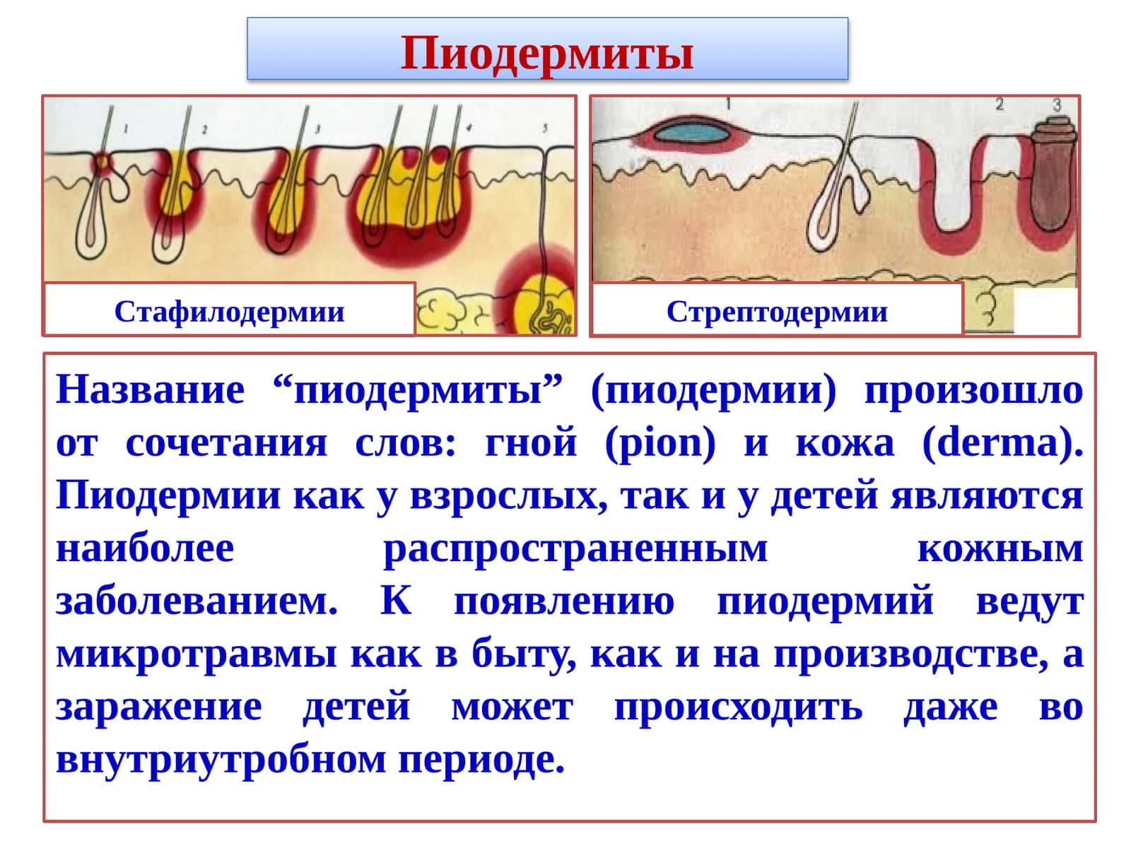 Пиодермиты 1