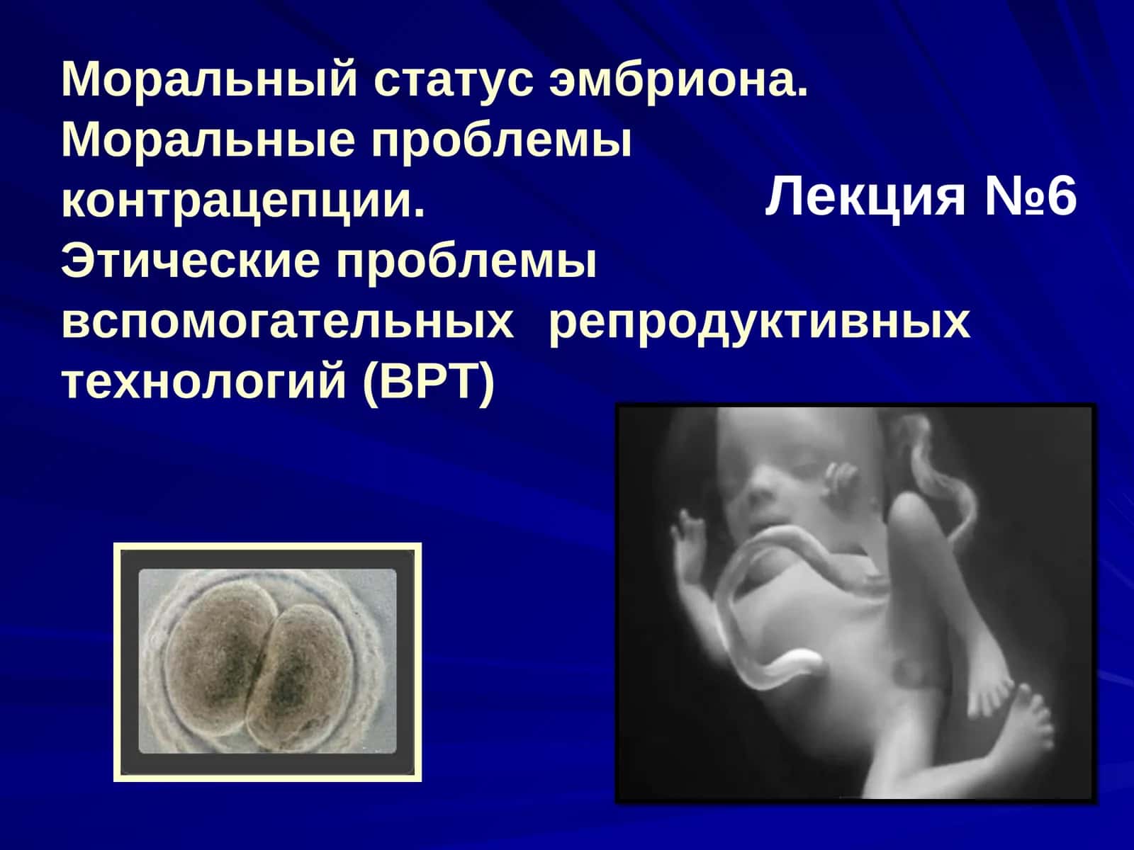 Моральный статус эмбриона 1