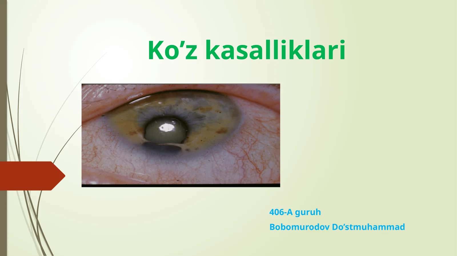 ko'z kasalliklari 1