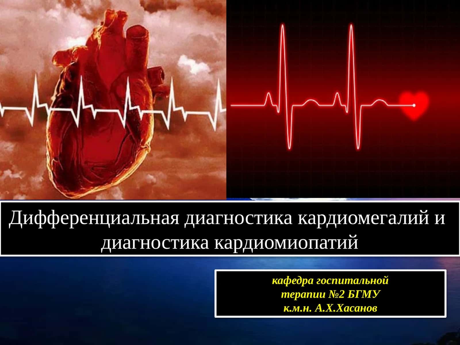 Дифференциальная диагностика кардиомегалий 1