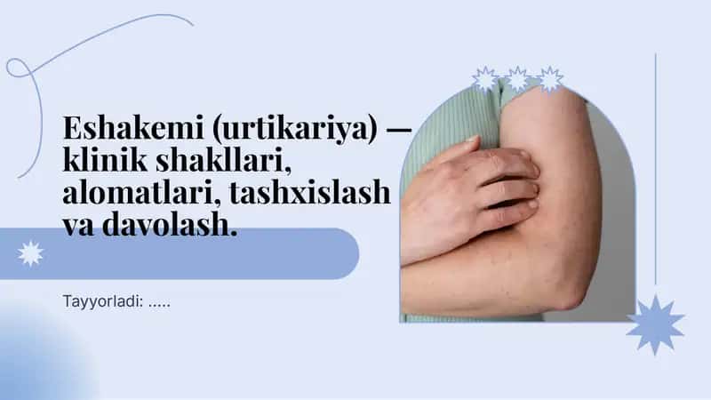 Eshakemi-urtikariya 1