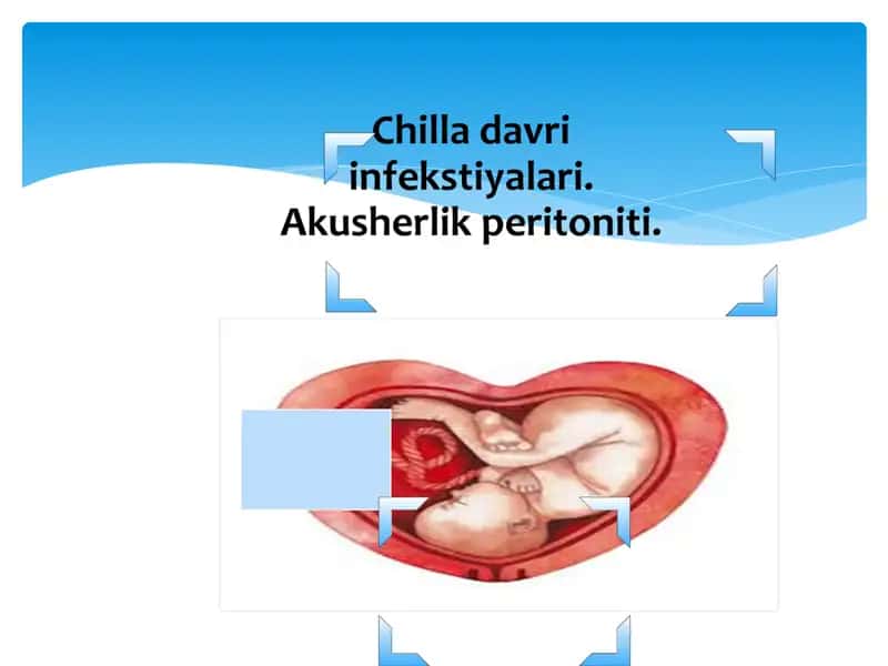 Chilla davri infekstiyalari. Akusherlik 1
