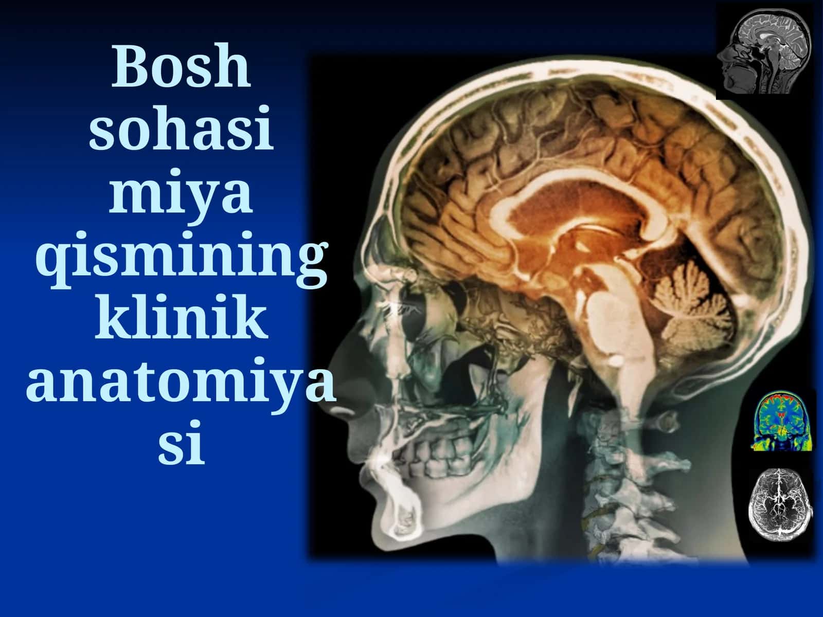 Bosh sohasi miya qismining klinik anatomiyasi 1