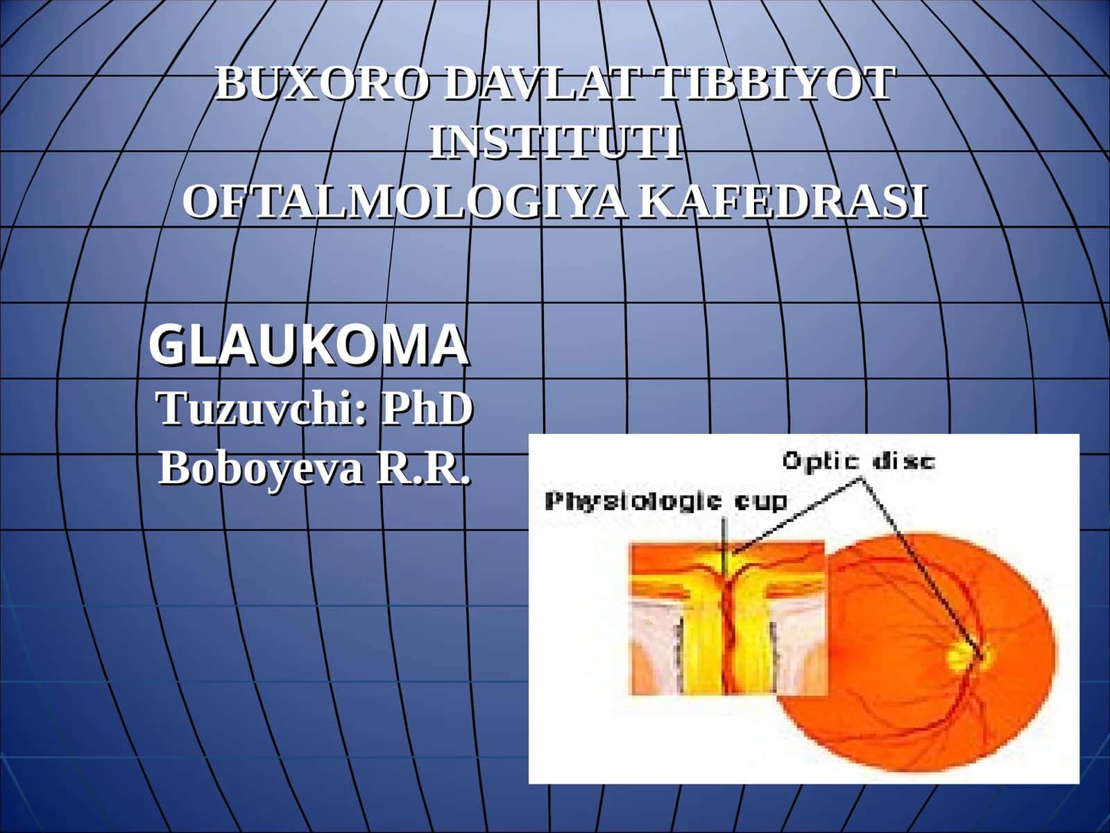 GLAUKOMA 1