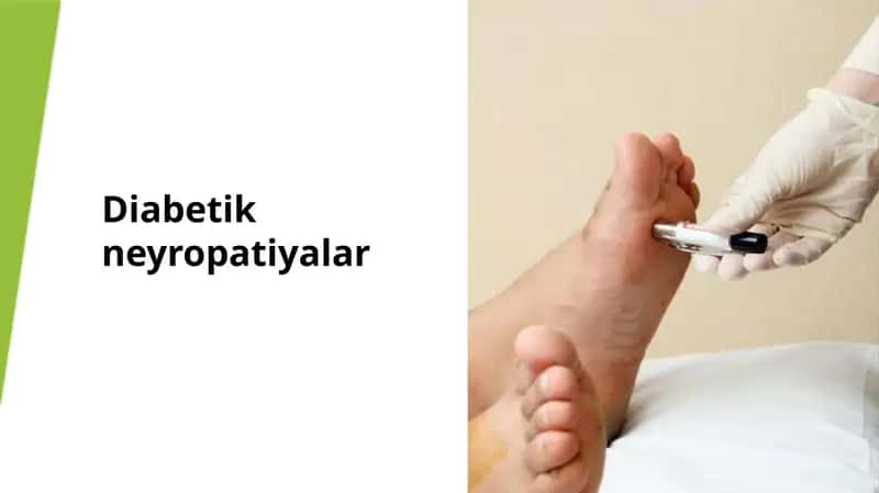 Diabetik neyropatiyalar 1