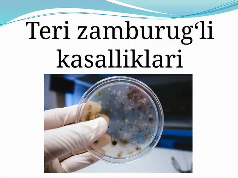 Terining zamburug‘li kasalliklari 1
