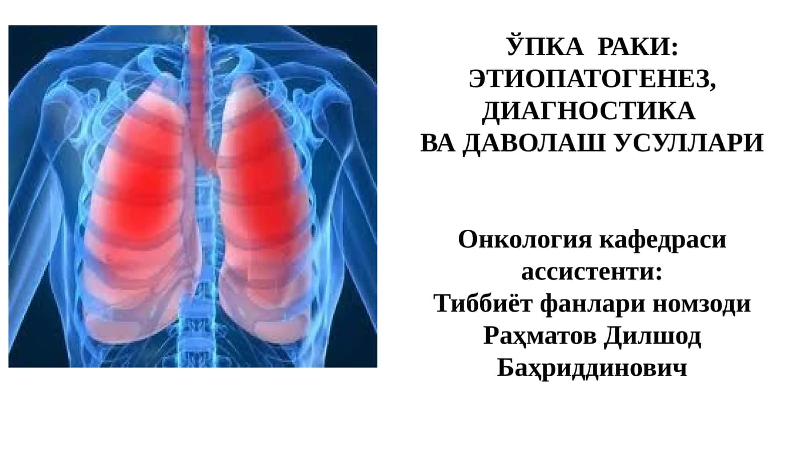 ЎПКА РАКИ: 1