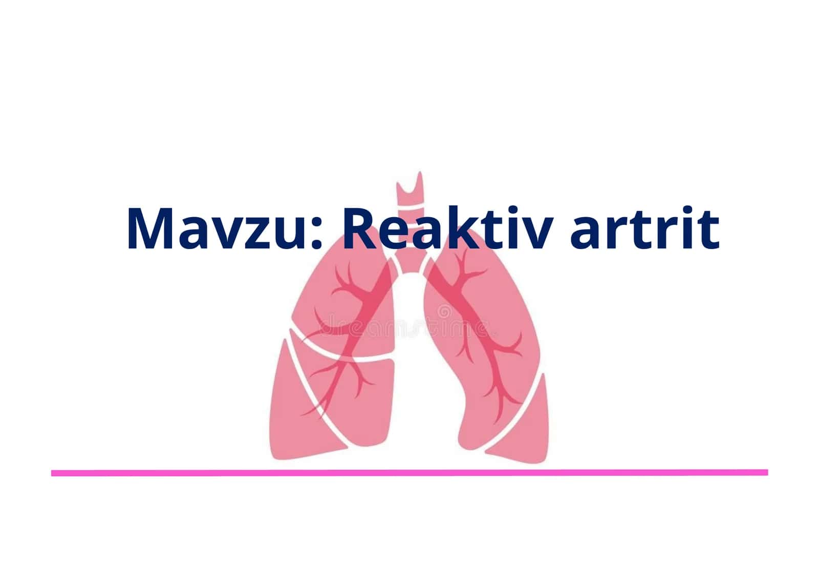 Reaktiv artrit 1