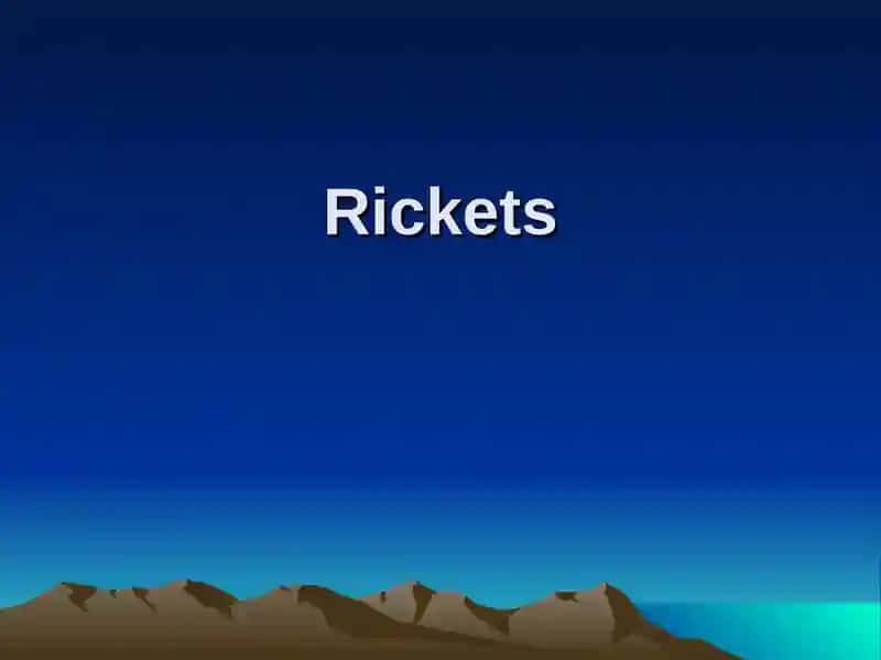 Rickets