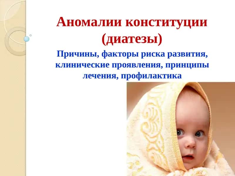 Аномалии конституции (диатезы) 1